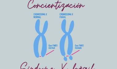 22 DE JULIO- DIA INTERNACIONAL DE LA CONCIENTIZACION DEL SINDROME X FRAGIL