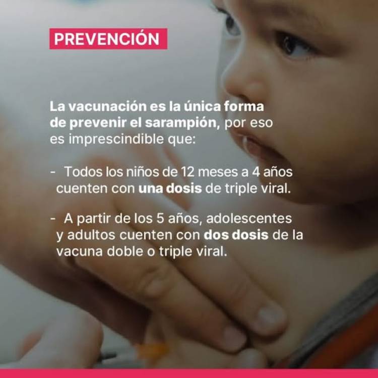 SAMCO RUFINO: SARAMPION