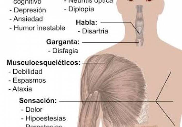 18 DE DICIEMBRE: DIA NACIONAL DE LA ESCLEROSIS MULTIPLE
