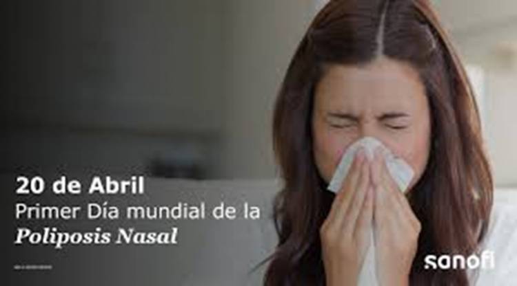 20 DE ABRIL: DIA MUNDIAL DE LA POLOPOSIS NASAL